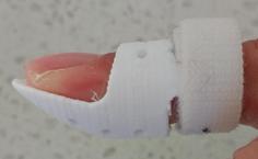 Stack Splint For Mallet Finger Injury 3D Printer Model