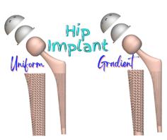 Lattice Structured Hip Implant 3D Printer Model