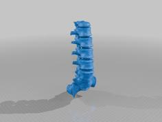 Lumbar Spine Model (with Congential Defects) 3D Printer Model