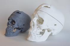 Skull Of Phineas Gage 3D Printer Model