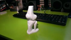 Knee Joint 3D Printer Model